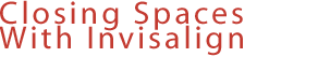 Closing Spaces with Invisalign