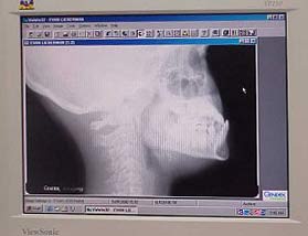x-ray