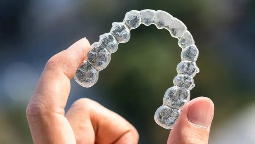 Why Seeking Treatment with an Invisalign Expert is a Very Smart Idea