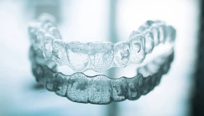 How to Clean Your Invisalign Aligners