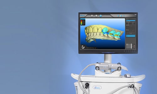 Why iTero Revolutionizes Orthodontic Treatment