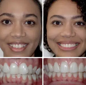 Dental X-ray showing teeth and jaw structure.