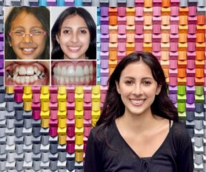 A young woman smiling in front of a colorful wall alongside her before and after orthodontic treatment photos